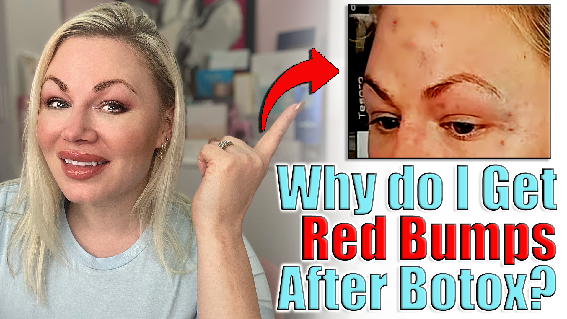 botox-tips-and-tricks